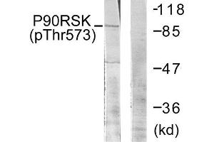 Western Blotting (WB) image for anti-Ribosomal Protein S6 Kinase, 90kDa, Polypeptide 3 (RPS6KA3) (pThr573) antibody (ABIN1847290) (RPS6KA3 Antikörper  (pThr573))