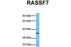 Host:  Rabbit  Target Name:  RASSF7  Sample Tissue:  Human A549  Antibody Dilution:  1. (RASSF7 Antikörper  (Middle Region))