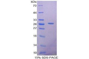 SDS-PAGE (SDS) image for SRY (Sex Determining Region Y)-Box 18 (SOX18) (AA 153-377) protein (His tag) (ABIN2126736)