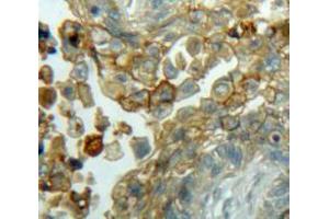 IHC-P analysis of Lung tissue, with DAB staining. (Cyclin D3 Antikörper  (AA 1-292))