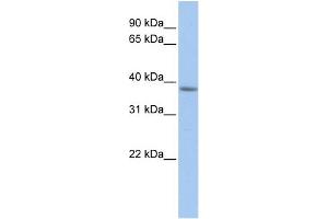 WB Suggested Anti-C2orf33 Antibody Titration:  0. (MFF Antikörper  (C-Term))