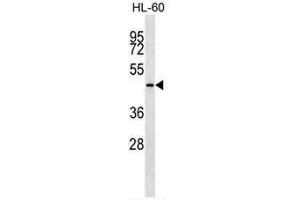 KRT28 Antibody (C-term) western blot analysis in HL-60 cell line lysates (35µg/lane). (Cytokeratin 28 Antikörper  (C-Term))