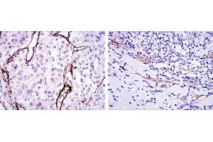 Immunohistochemistry (IHC) image for anti-Endoglin (ENG) antibody (ABIN969012)