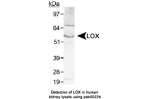 Image no. 2 for anti-Lysyl Oxidase (LOX) (AA 200-300), (Internal Region) antibody (ABIN363533) (LOX Antikörper  (Internal Region))