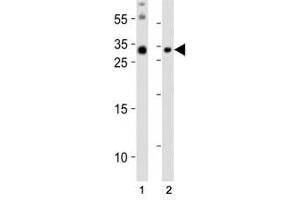 Western blot analysis of lysate from (1) mouse brain and (2) mouse skeletal muscle tissue lysate using Olig3 antibody at 1:1000. (OLIG3 Antikörper  (N-Term))