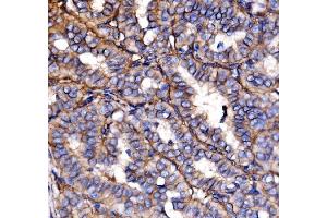 IHC analysis of NEAS/SPTAN1 using anti-NEAS/SPTAN1 antibody (ABIN7600436). (SPTAN1 Antikörper  (AA 1916-2472))