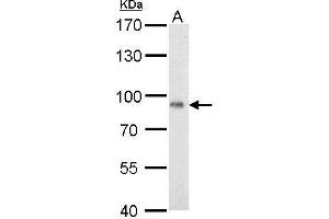 Western Blotting (WB) image for anti-P450 (Cytochrome) Oxidoreductase (POR) (N-Term) antibody (ABIN2854935)