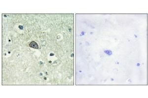 Immunohistochemical analysis of paraffin-embedded human brain tissue using NMDAR1 (Phospho-Ser890) antibody (left)or the same antibody preincubated with blocking peptide (right). (GRIN1/NMDAR1 Antikörper  (pSer890))