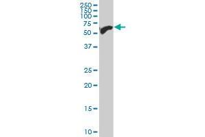 SIM2 polyclonal antibody (A01), Lot # O51024JC01 Western Blot analysis of SIM2 expression in HepG2 . (SIM2 Antikörper  (AA 426-525))