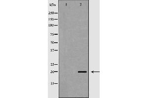 Western blot analysis of Hepg2 whole cell lysates, using TAF9 Antibody. (TAF9 Antikörper  (Internal Region))
