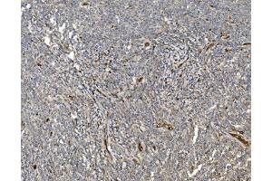 IHC analysis of EIF3C using anti-EIF3C antibody (ABIN7602528).