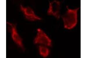 ABIN6277108 staining HuvEc cells by IF/ICC. (CD90 Antikörper  (Internal Region))