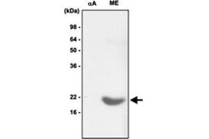 Western blot analysis of recombinant alpha - crystallin A (alphaA) and mouse eye (ME) extract were resolved by SDS - PAGE , transferred to PVDF membrane and probed with CRYAB monoclonal antibody , clone 2E8 (1 : 1000)  .