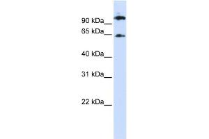 WB Suggested Anti-RUNX1T1 Antibody Titration: 0. (RUNX1T1 Antikörper  (Middle Region))