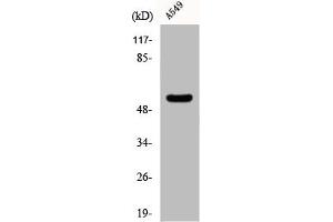 Western Blot analysis of Jurkat cells using CHST2 Polyclonal Antibody (CHST2 Antikörper  (N-Term))