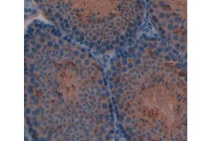 Used in DAB staining on fromalin fixed paraffin- embedded Kidney tissue (CYP11A1 Antikörper  (AA 329-526))