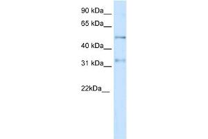 WB Suggested Anti-KCNAB2 Antibody Titration:  0. (KCNAB2 Antikörper  (Middle Region))