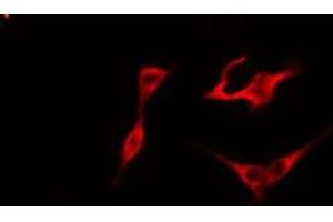 ABIN6275755 staining COLO205 cells by IF/ICC. (STARD10 Antikörper  (Internal Region))