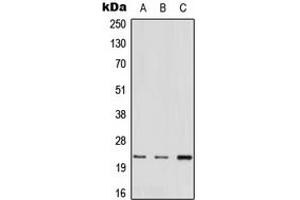 Western blot analysis of MED22 expression in A549 (A), mouse heart (B), rat liver (C) whole cell lysates. (MED22 Antikörper  (N-Term))