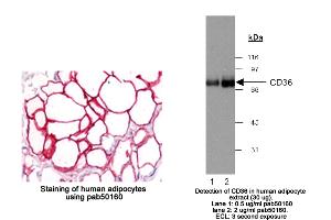 Image no. 3 for anti-CD36 (CD36) (AA 100-200) antibody (ABIN363469) (CD36 Antikörper  (AA 100-200))