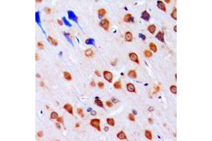 Immunohistochemical analysis of CHK1 staining in human brain formalin fixed paraffin embedded tissue section. (CHEK1 Antikörper  (Center))