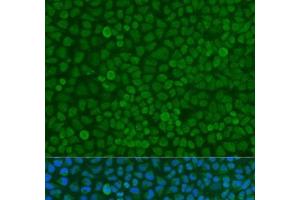 Immunofluorescence analysis of U2OS cells using YWHAZ Polyclonal Antibody at dilution of 1:100. (14-3-3 zeta Antikörper)