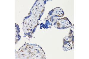 Immunohistochemistry of paraffin-embedded human placenta using ErbB4/HER4 Rabbit pAb (ABIN6131263, ABIN6140257, ABIN6140260 and ABIN6221732) at dilution of 1:100 (40x lens). (ERBB4 Antikörper  (AA 26-160))