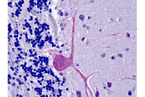 Anti-OSBPL1A / ORP1 antibody IHC of human brain, cerebellum. (OSBPL1A Antikörper  (AA 938-950))