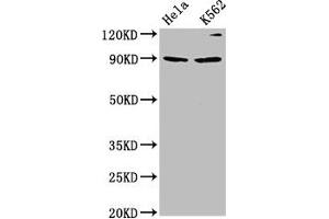 Western Blot Positive WB detected in: Hela whole cell lysate, K562 whole cell lysate All lanes: KIF3C antibody at 4. (KIF3C Antikörper  (AA 158-267))