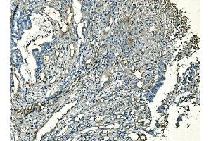 IHC analysis of CD59 using anti-CD59 antibody (ABIN7600941).