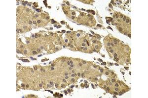 Immunohistochemistry of paraffin-embedded Human stomach using SETD5 Polyclonal Antibody at dilution of 1:100 (40x lens). (SETD5 Antikörper)