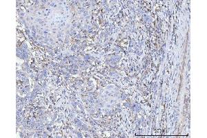 IHC analysis of FACL4/ACSL4 using anti-FACL4/ACSL4 antibody (ABIN7602779). (ACSL4 Antikörper  (C-Term))