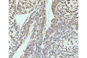 IHC analysis of GIT1 using anti-GIT1 antibody (ABIN7601683). (GIT1 Antikörper  (AA 415-736))
