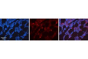 Rabbit Anti-CDK6 Antibody  AV Formalin Fixed Paraffin Embedded Tissue: Human Bone Marrow Tissue Observed Staining: Cytoplasm, Nucleus Primary Antibody Concentration: 1:100 Other Working Concentrations: N/A Secondary Antibody: Donkey anti-Rabbit-Cy3 Secondary Antibody Concentration: 1:200 Magnification: 20X Exposure Time: 0. (CDK6 Antikörper  (C-Term))