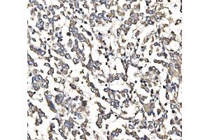 IHC analysis of 5HT1B/HTR1B using anti-5HT1B/HTR1B antibody (ABIN7601425).