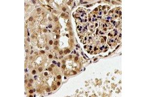 Immunohistochemical analysis of ALG-2 staining in rat kidney formalin fixed paraffin embedded tissue section. (ALG2 Antikörper)