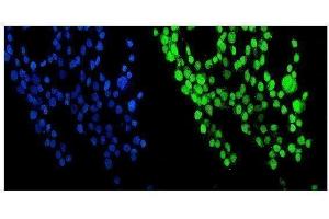 IF analysis of NUP214 using anti-NUP214 antibody (ABIN7601473). (NUP214 Antikörper  (AA 36-374))