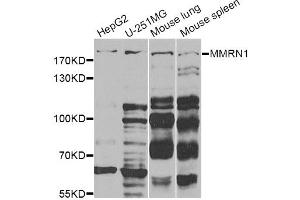 Western blot analysis of extracts of various cell lines, using MMRN1 Antibody (ABIN2563895) at 1:1000 dilution.