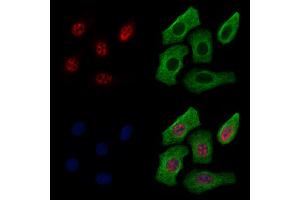 ABIN7094715 and ABIN7098766 staining Hela cells by IF/ICC.