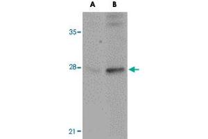 Western blot analysis of GOLPH3 in rat lung tissue lysate with GOLPH3 polyclonal antibody  at (A) 0. (GOLPH3 Antikörper  (N-Term))