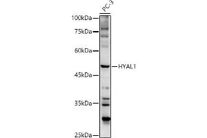 Western blot analysis of extracts of PC-3 cells, using HY antibody  at 1:500 dilution.