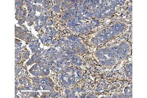 IHC analysis of Integrin beta 5/ITGB5 using anti-Integrin beta 5/ITGB5 antibody (ABIN7601319).