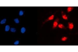 IF analysis of GCKR using anti-GCKR antibody (ABIN7602493). (GCKR Antikörper  (AA 8-569))