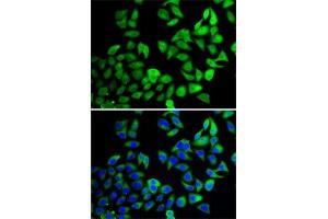 Immunofluorescence analysis of A-549 cells using USP8 antibody (ABIN6132776, ABIN6150035, ABIN6150036 and ABIN6222811). (USP8 Antikörper  (AA 1-270))
