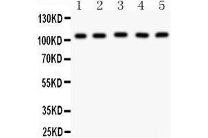 Anti- MSH2 Picoband antibody, Western blotting All lanes: Anti MSH2  at 0. (MSH2 Antikörper  (AA 337-583))