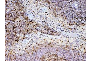 Immunohistochemistry (IHC) image for anti-Adenosine Deaminase (ADA) (AA 2-238) antibody (ABIN5692790)