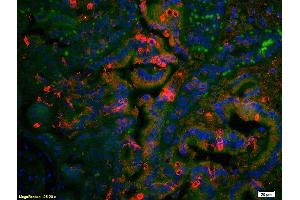 Formalin-fixed and paraffin embedded rat colon tissue labeled with Anti AT2R/AT1 Polyclonal Antibody, Unconjugated (ABIN668616) at 1:200 followed by secondary antibody was Goat Anti-Rabbit IgG, Cy3 conjugated  used at 1:200 dilution for 40 minutes at 37 °C. (Angiotensin II Type 2 Receptor Antikörper)