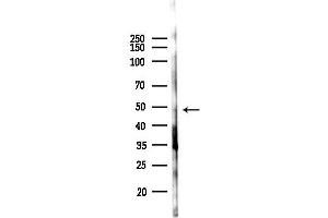 Western blot analysis of lysates from Hela cells(starvation 24h treatment), using Phospho-Parkin (Ser131) Antibody at 1/1000 dilution.