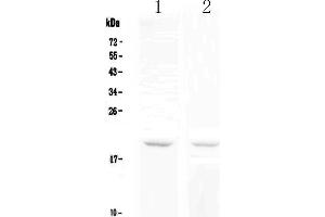 Western blot analysis of BCMA using anti-BCMA antibody . (BCMA Antikörper  (AA 1-54))