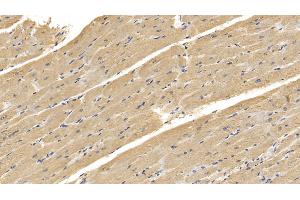 Detection of RNLS in Human Cardiac Muscle Tissue using Monoclonal Antibody to Renalase (RNLS)